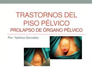 trastornos del piso p lvico prolapso de rgano p lvico
