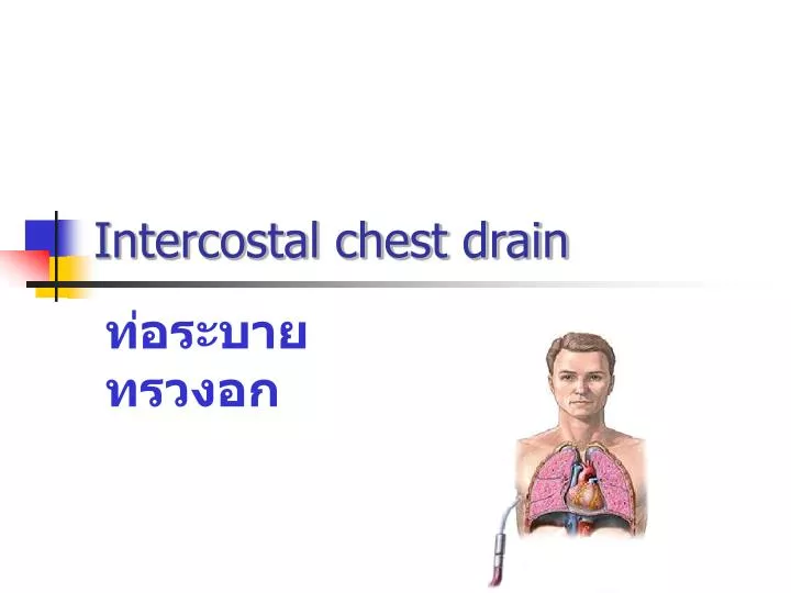 intercostal chest drain