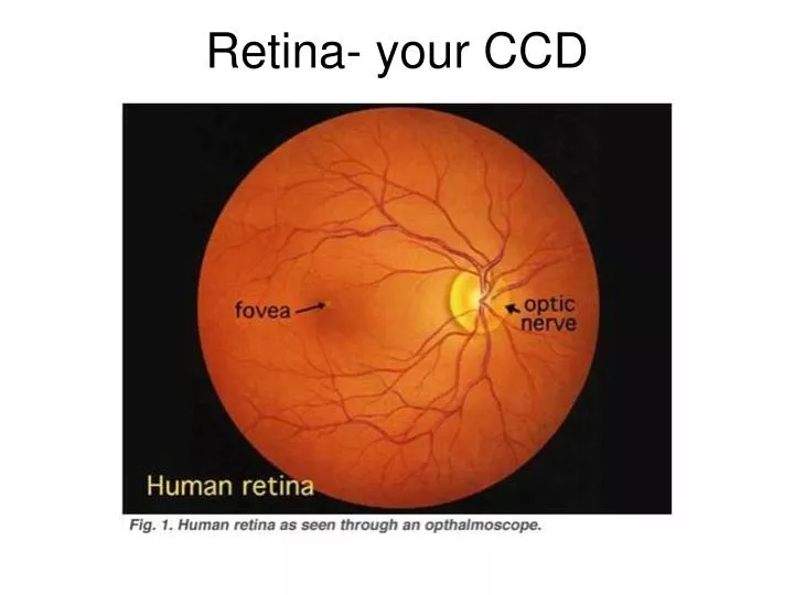 retina your ccd