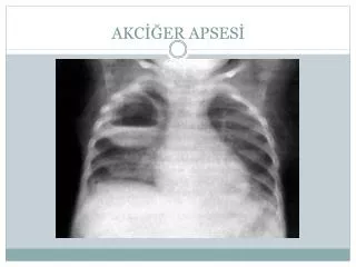 akc er apses