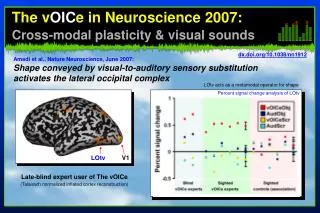 The v OIC e in Neuroscience 2007: Cross-modal plasticity &amp; visual sounds