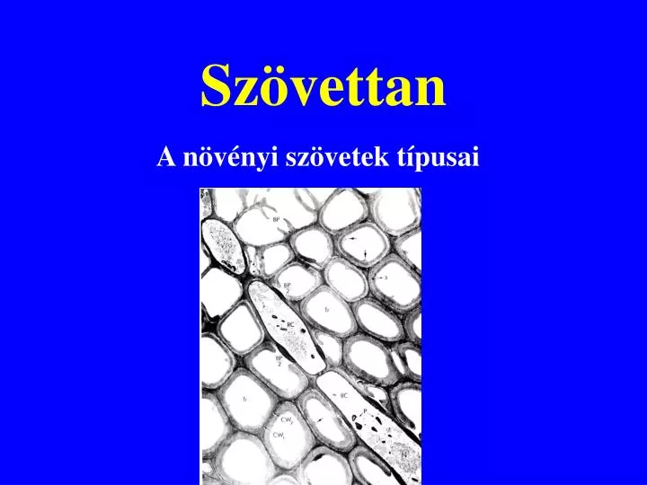 sz vettan