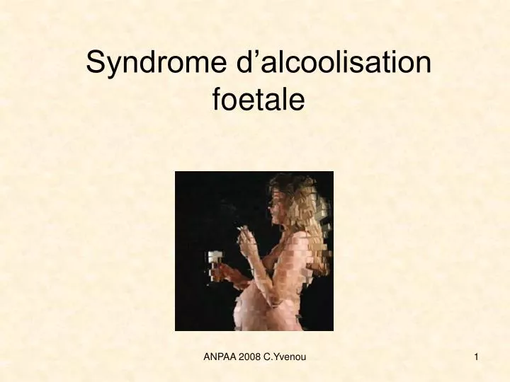 syndrome d alcoolisation foetale