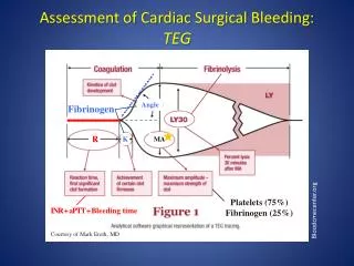 Assessment of Cardiac Surgical Bleeding: TEG