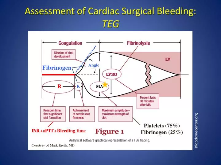 assessment of cardiac surgical bleeding teg