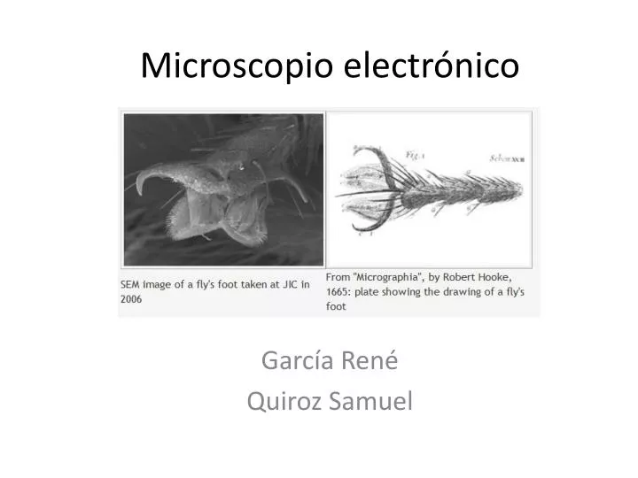 microscopio electr nico