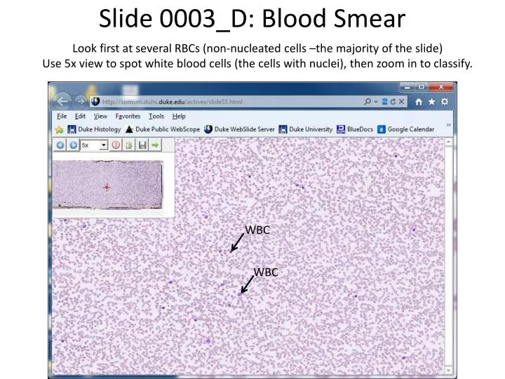 slide 0003 d blood smear