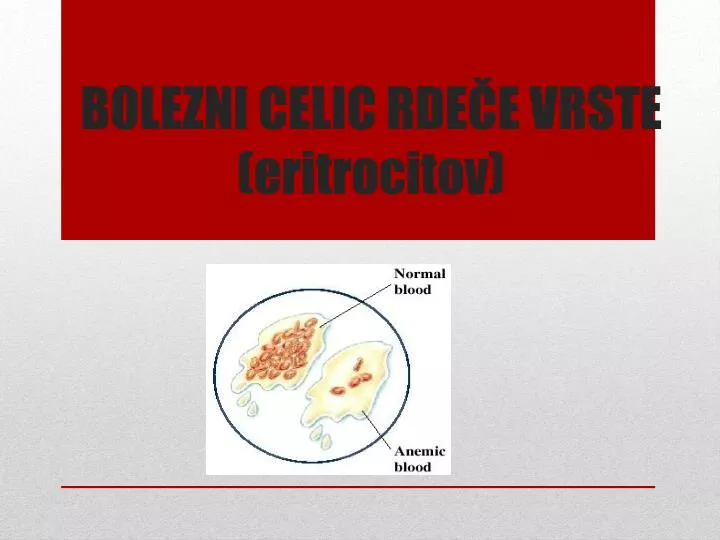 bolezni celic rde e vrste eritrocitov