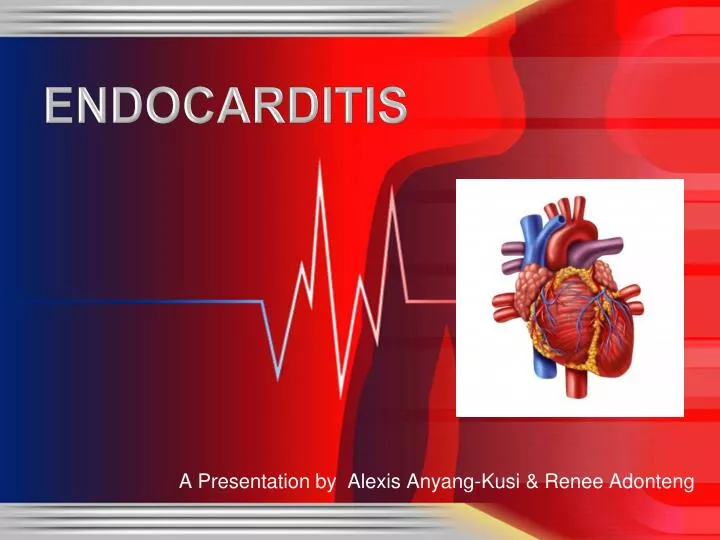 endocarditis