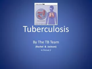 Tuberculosis