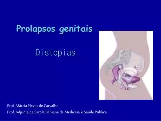 prolapsos genitais
