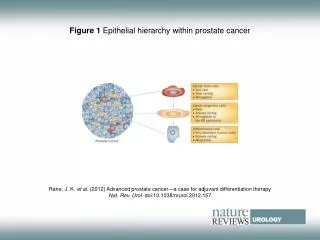 Figure 1 Epithelial hierarchy within prostate cancer