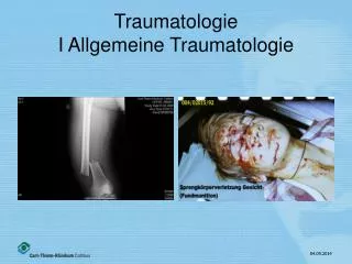 traumatologie i allgemeine traumatologie