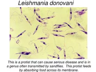 Leishmania donovani