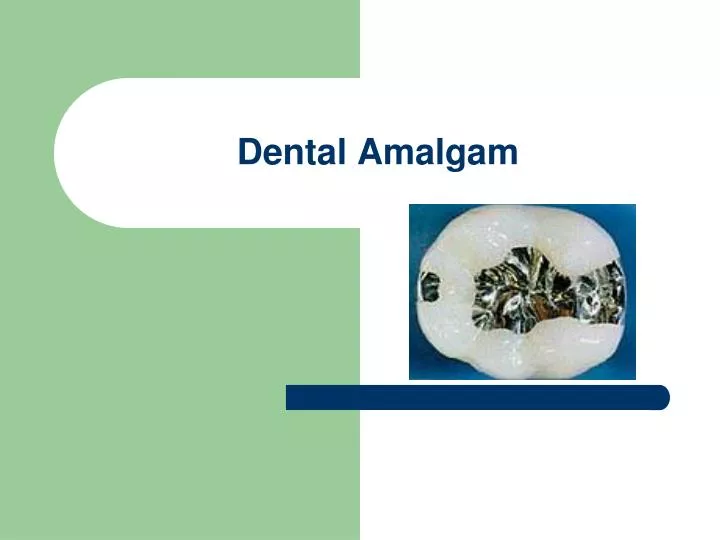 dental amalgam