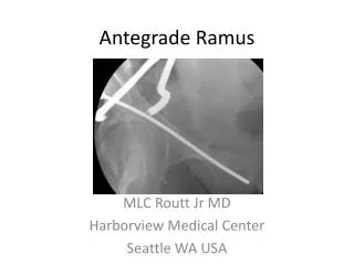 antegrade ramus