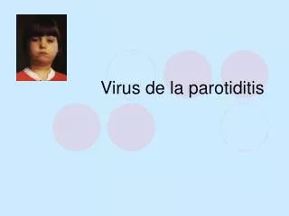 virus de la parotiditis