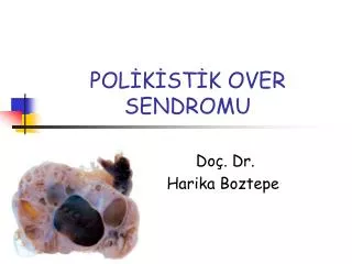 pol k st k over sendromu