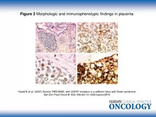 Figure 2 Morphologic and immunophenotypic findings in placenta