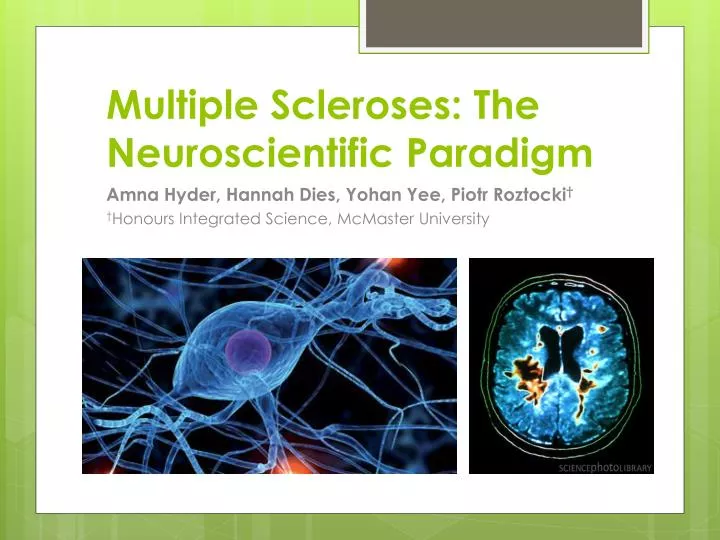 multiple scleroses the neuroscientific paradigm