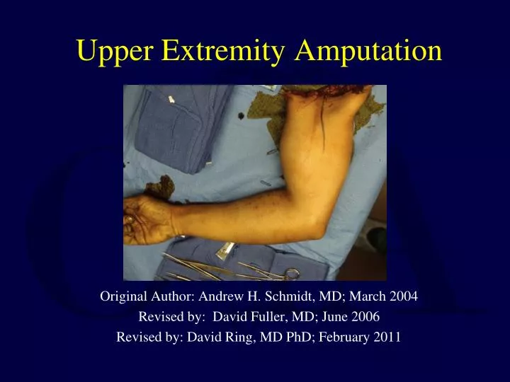 upper extremity amputation