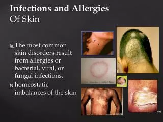 Infections and Allergies Of Skin