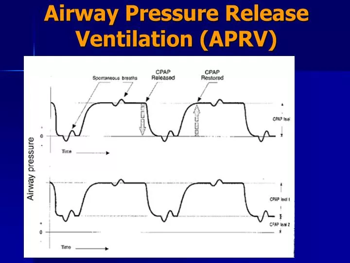 airway pressure release ventilation aprv