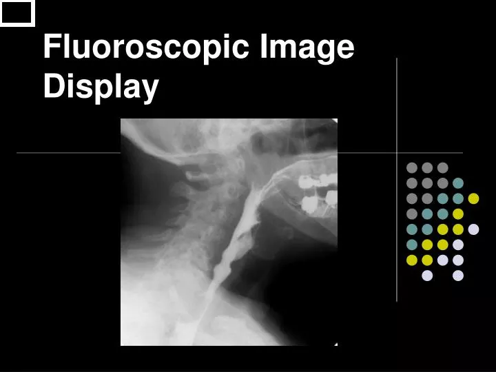 fluoroscopic image display