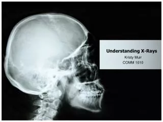 Understanding X-Rays