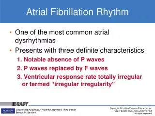 Atrial Fibrillation Rhythm