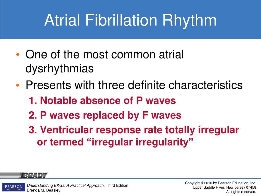 PPT - Atrial Fibrillation Rhythm PowerPoint Presentation, free download ...