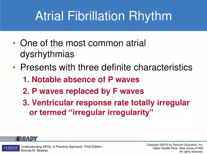 atrial fibrillation rhythm