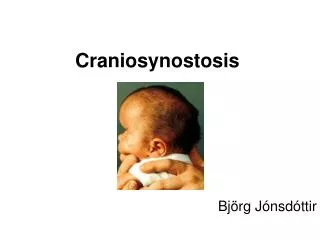 craniosynostosis