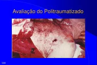 avalia o do politraumatizado