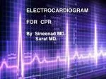 ELECTROCARDIOGRAM - slide 1
