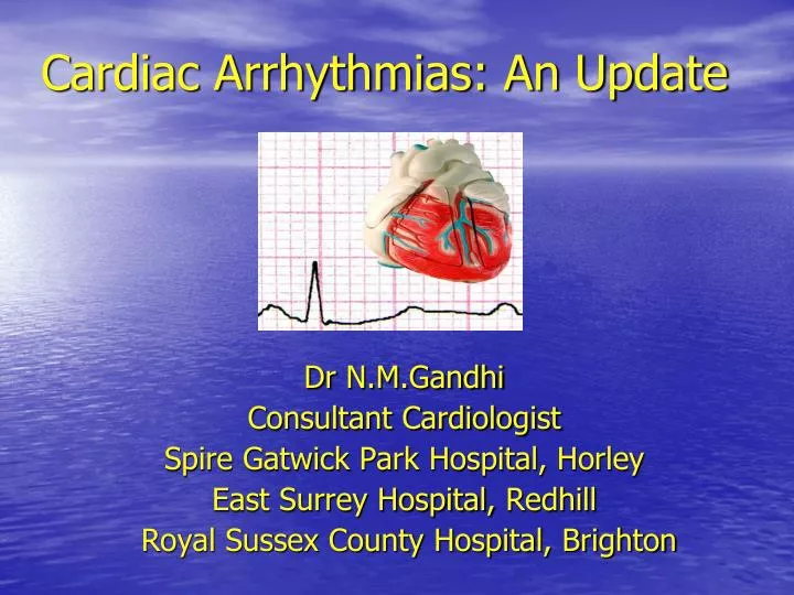cardiac arrhythmias an update