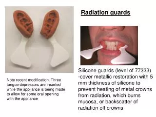 Silicone guards (level of 77333)