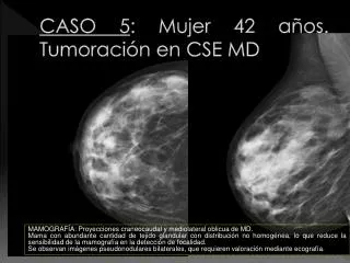 caso 5 mujer 42 a os tumoraci n en cse md
