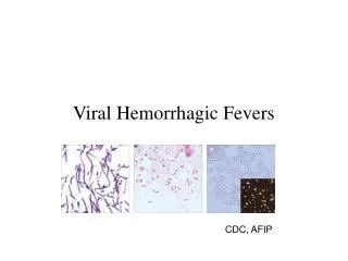 Viral Hemorrhagic Fevers