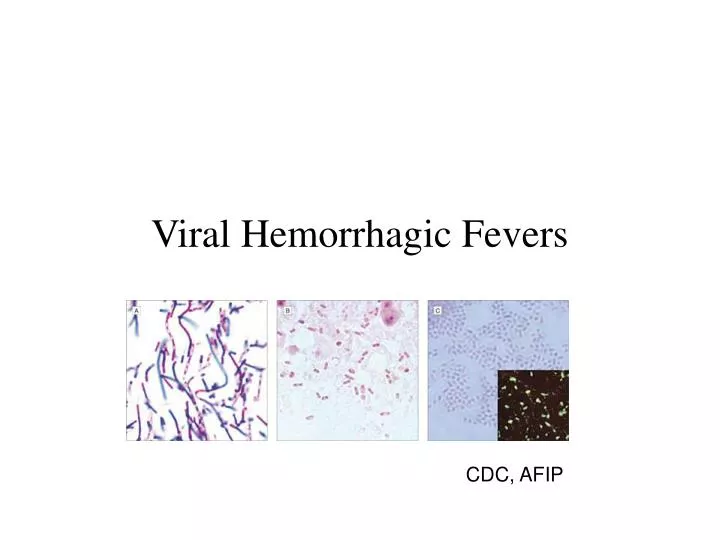 viral hemorrhagic fevers