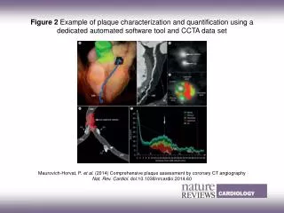 Maurovich-Horvat, P. et al. (2014) Comprehensive plaque assessment by coronary CT angiography