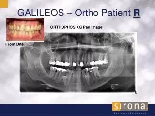 GALILEOS – Ortho Patient R