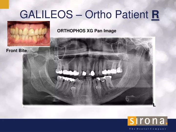 galileos ortho patient r