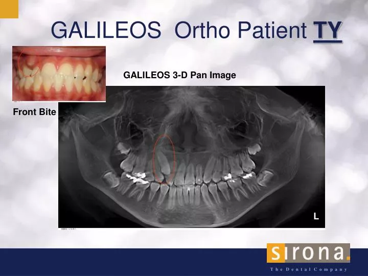 galileos ortho patient ty
