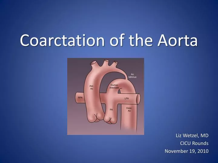 c oarctation of the aorta