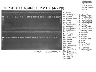 RT-PCR: CIDEA,CIDE-A , T92 T93 (477 bp)