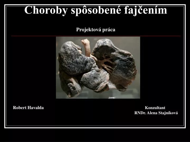 choroby sp soben faj en m projektov pr ca