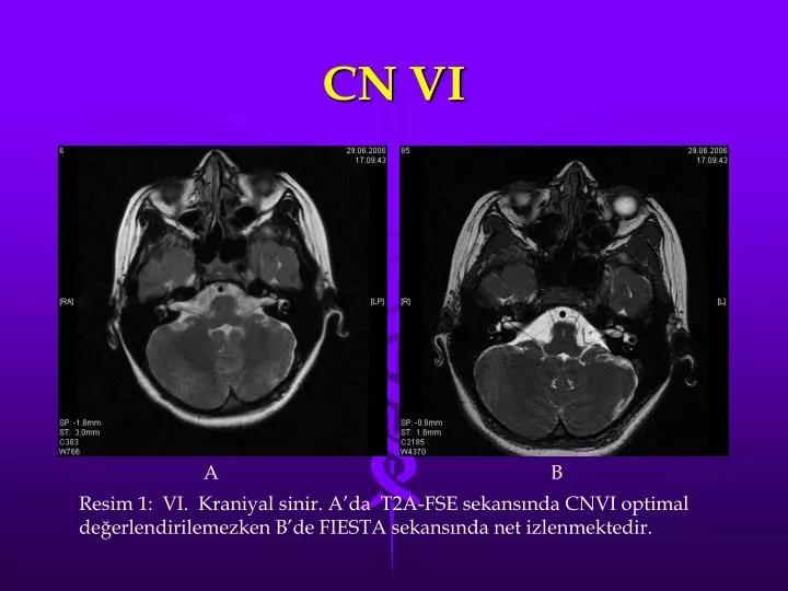 cn vi