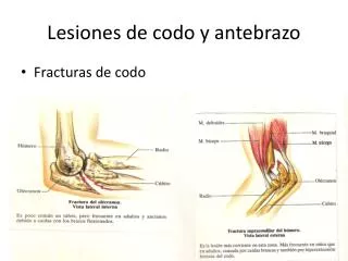 lesiones de codo y antebrazo