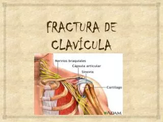 fractura de clav cula